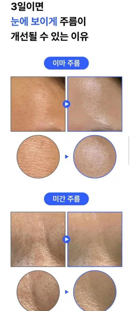 기미주름 피부장벽 세니지아 유니크미 마이크로마이옴 세라마이드 리포좀 앰플